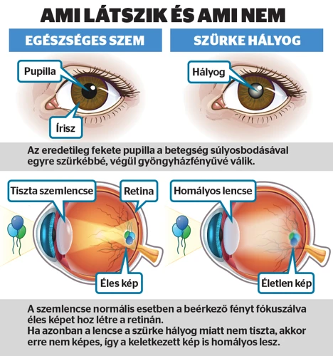 Az Áriesz És A Pénzügyek